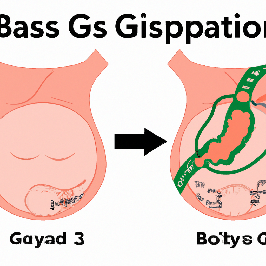 A detailed illustration of gastric bypass complication.