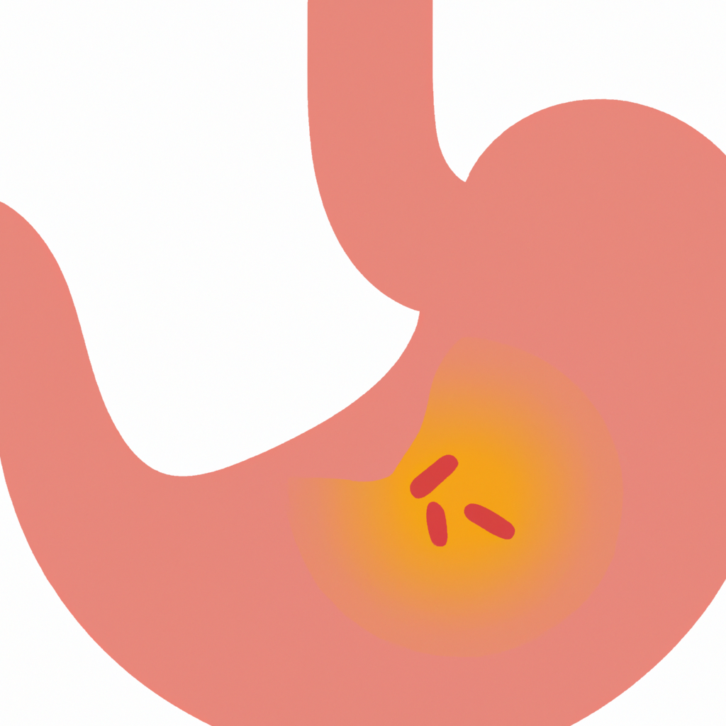 Illustration of stomach acid reflux problem.